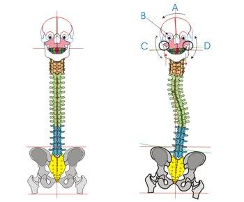 Squilibrio Cranio-Mandibolo-Vertebrale (ATM)